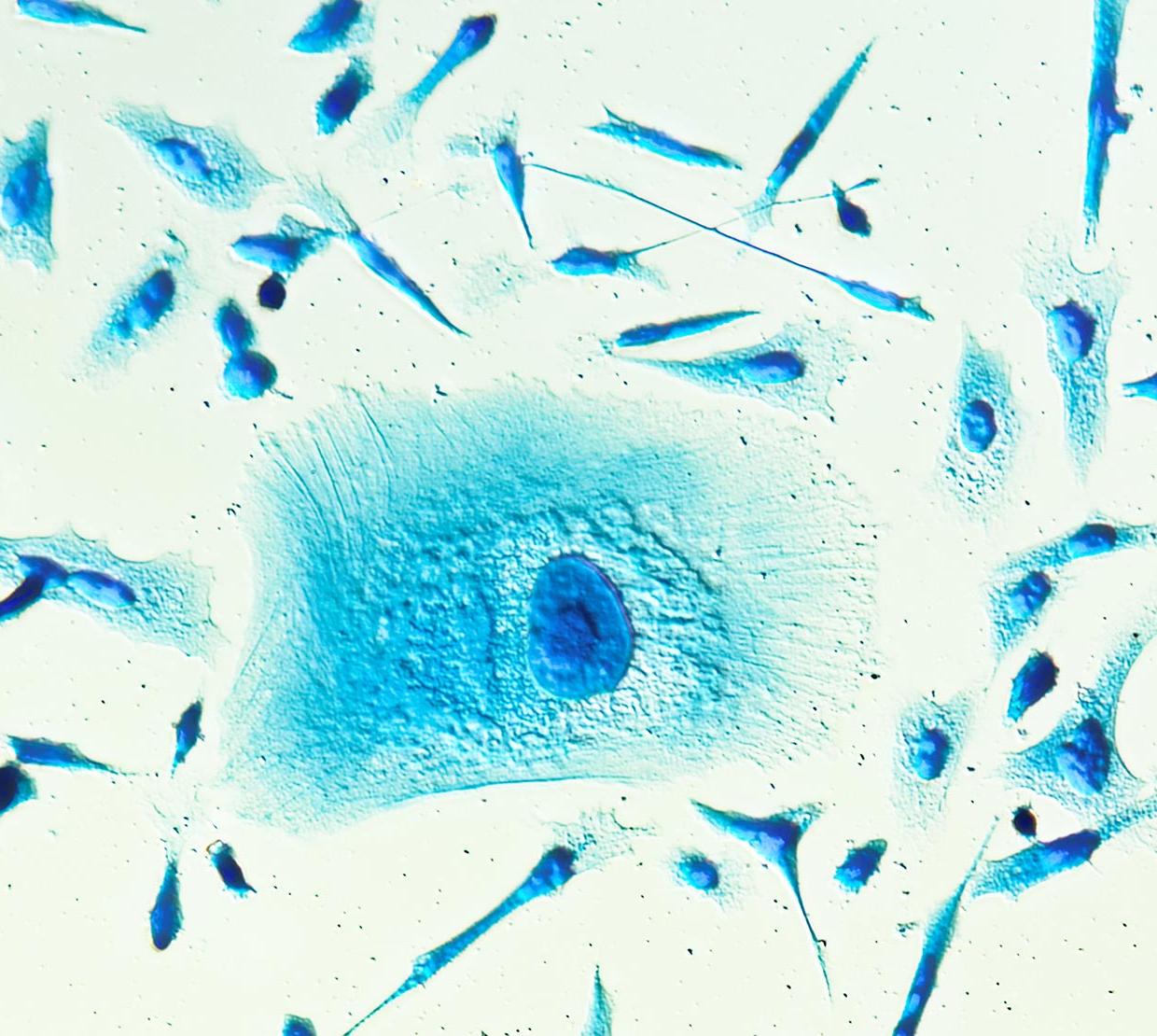 microscopic image of blue PC-3 cancer cells 